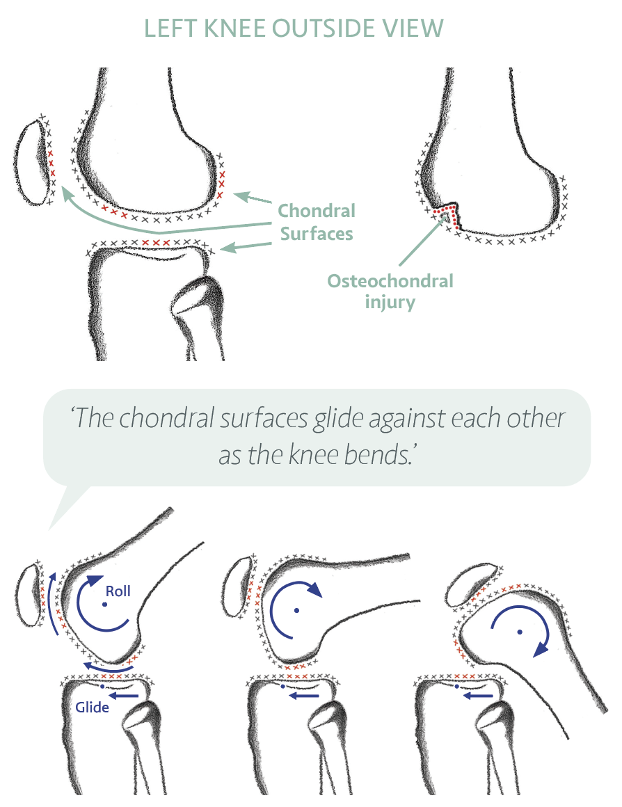The glide layer