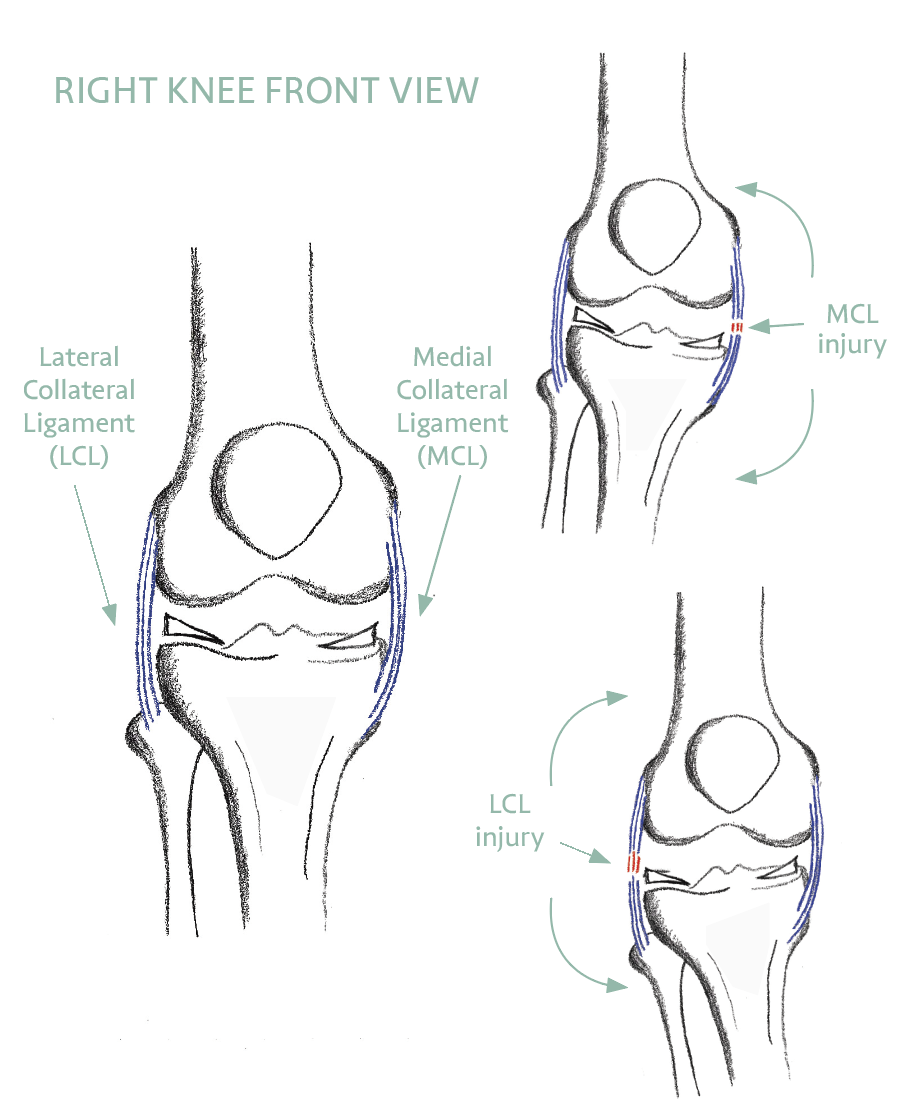 Side-to-side stability
